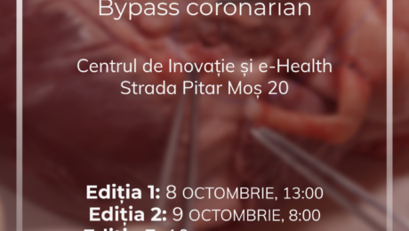FDI bypass