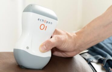 Ultrasonografie _n